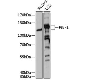 Western Blot - Anti-PIBF Antibody (A80922) - Antibodies.com