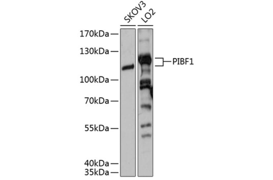 Western Blot - Anti-PIBF Antibody (A80922) - Antibodies.com