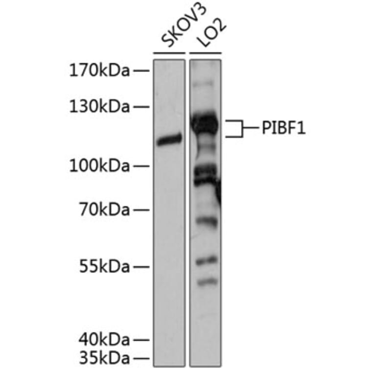 Western Blot - Anti-PIBF Antibody (A80922) - Antibodies.com