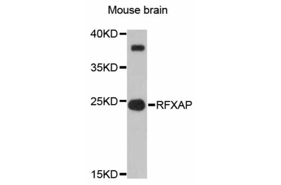 Western Blot - Anti-RFXAP Antibody (A12035) - Antibodies.com