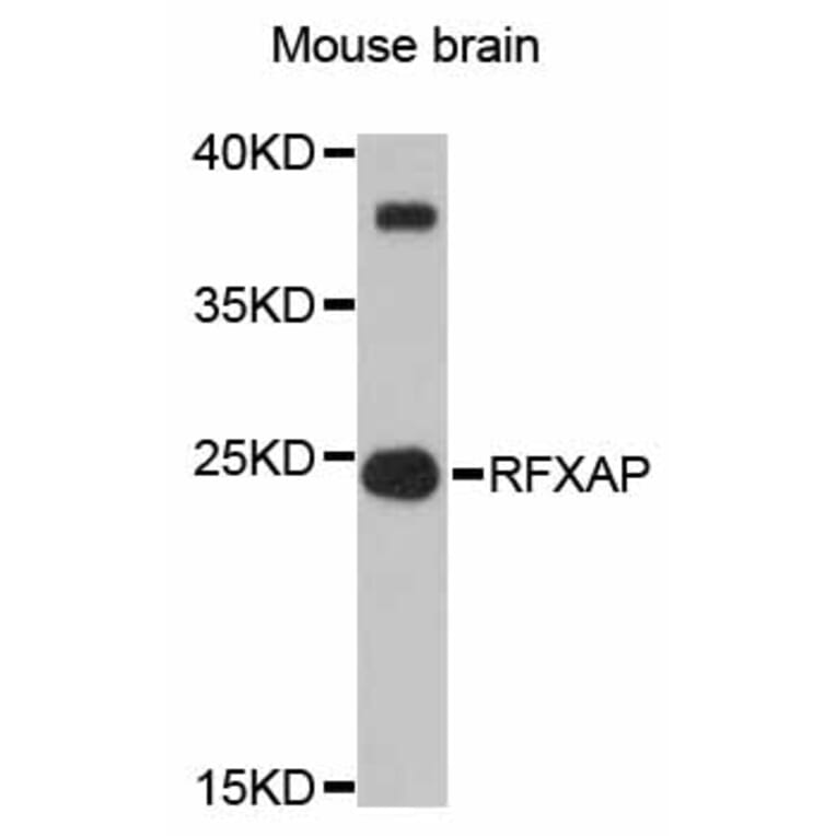 Western Blot - Anti-RFXAP Antibody (A12035) - Antibodies.com