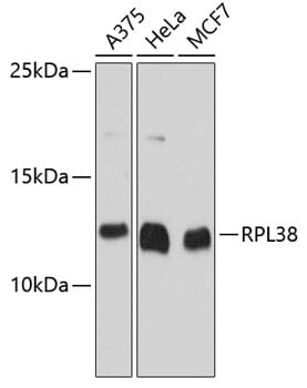 Western blot analysis of extracts of various cell lines, using Anti-RPL38 Antibody (A12038) at 1:3000 dilution.
Secondary antibody: Goat Anti-Rabbit IgG (H+L) (HRP) (AS014) at 1:10,000 dilution.
Lysates / proteins: 25µg per lane.
Blocking buffer: 3% non-fat dry milk in TBST.
Detection: ECL Basic Kit (RM00020).
Exposure time: 30s.