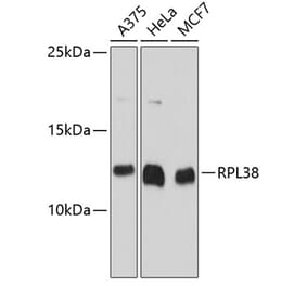Western Blot - Anti-RPL38 Antibody (A80924) - Antibodies.com