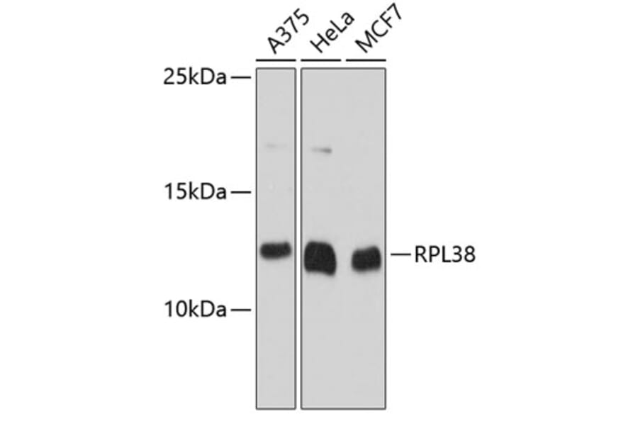 Western Blot - Anti-RPL38 Antibody (A80924) - Antibodies.com