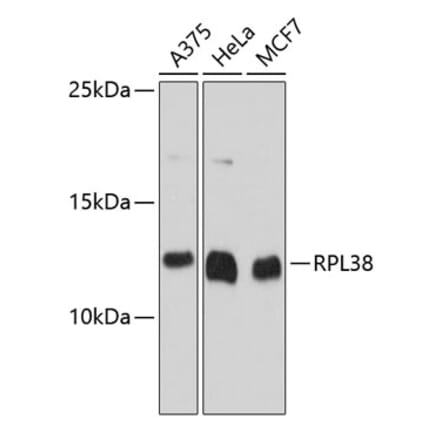 Western Blot - Anti-RPL38 Antibody (A80924) - Antibodies.com