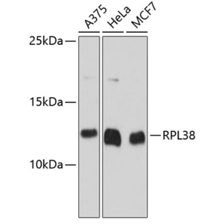 Western Blot - Anti-RPL38 Antibody (A80924) - Antibodies.com