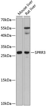 Western blot analysis of extracts of various cell lines, using Anti-SPRR3 Antibody (A12041) at 1:3000 dilution.
Secondary antibody: Goat Anti-Rabbit IgG (H+L) (HRP) (AS014) at 1:10,000 dilution.
Lysates / proteins: 25µg per lane.
Blocking buffer: 3% non-fat dry milk in TBST.
Detection: ECL Basic Kit (RM00020).
Exposure time: 90s.
