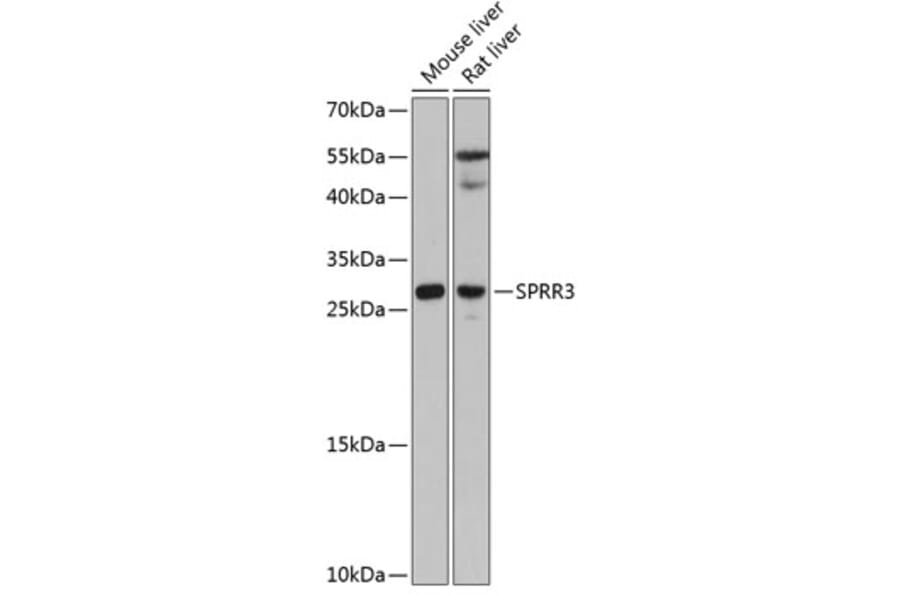 Western Blot - Anti-SPRR3 Antibody (A80925) - Antibodies.com