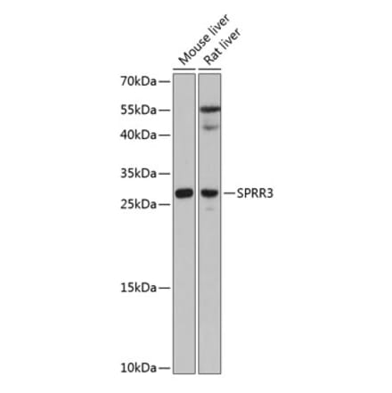 Western Blot - Anti-SPRR3 Antibody (A80925) - Antibodies.com