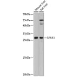 Western Blot - Anti-SPRR3 Antibody (A80925) - Antibodies.com