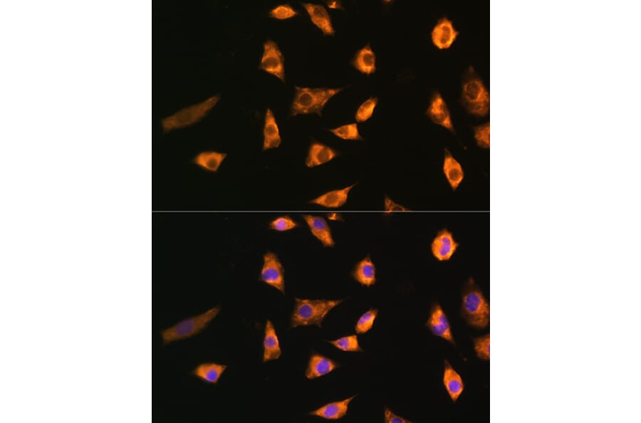 Immunofluorescence - Anti-SPRR3 Antibody (A80925) - Antibodies.com