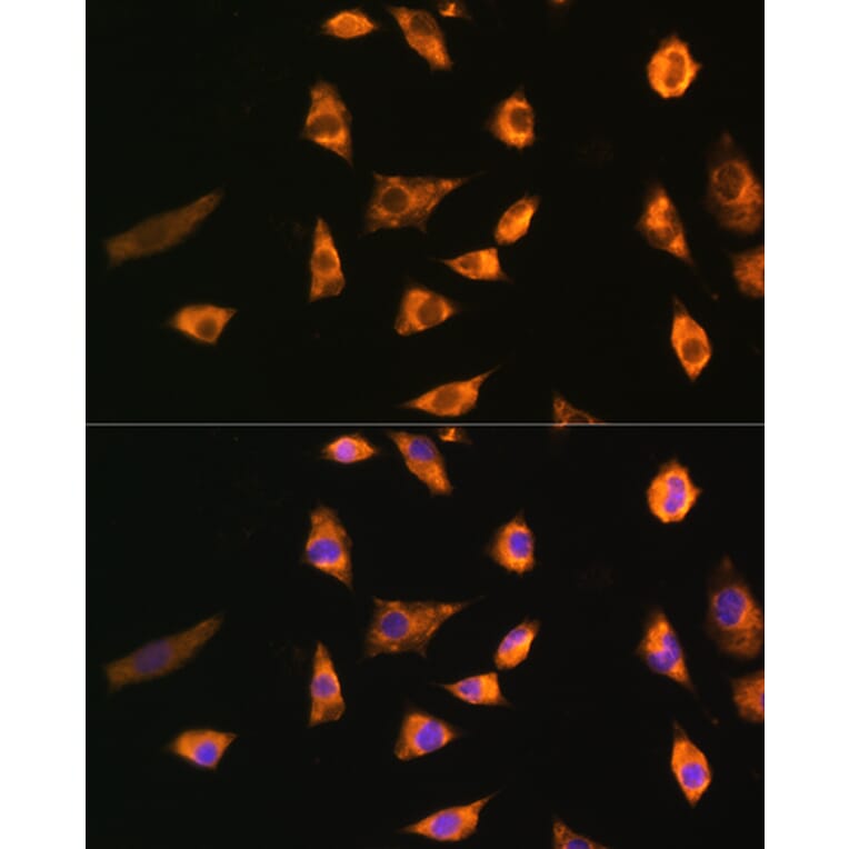 Immunofluorescence - Anti-SPRR3 Antibody (A80925) - Antibodies.com