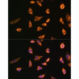 Immunofluorescence - Anti-SPRR3 Antibody (A80925) - Antibodies.com
