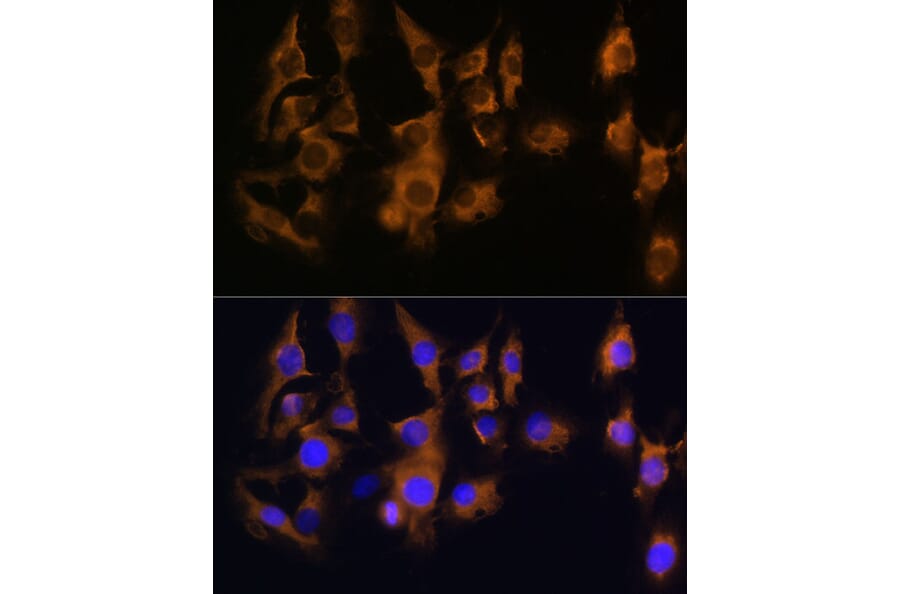 Immunofluorescence - Anti-SPRR3 Antibody (A80925) - Antibodies.com