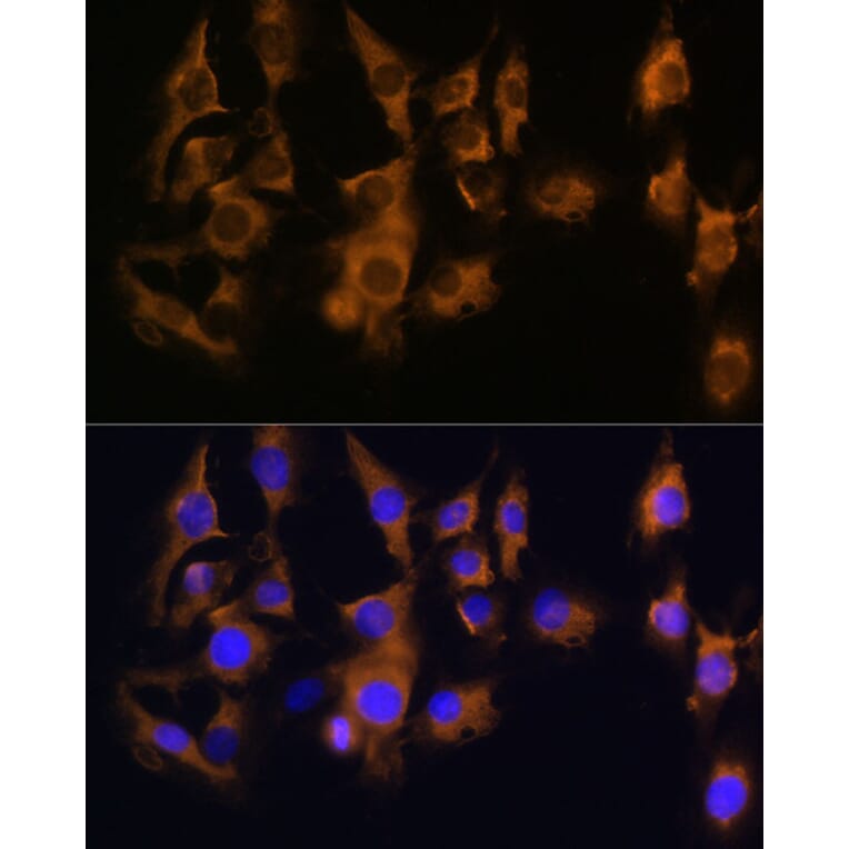 Immunofluorescence - Anti-SPRR3 Antibody (A80925) - Antibodies.com
