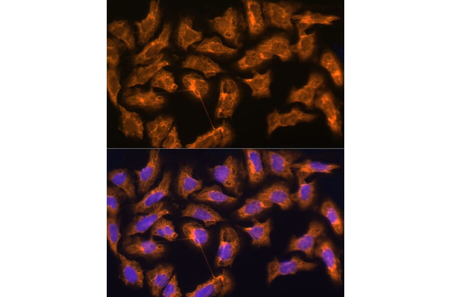 Immunofluorescence - Anti-SPRR3 Antibody (A80925) - Antibodies.com