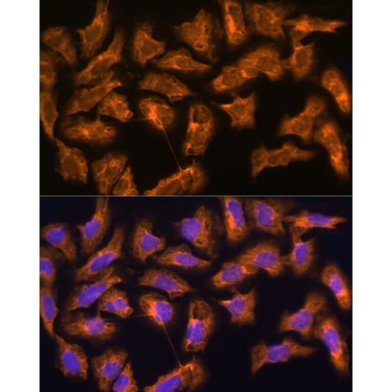 Immunofluorescence - Anti-SPRR3 Antibody (A80925) - Antibodies.com