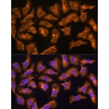 Immunofluorescence - Anti-SPRR3 Antibody (A80925) - Antibodies.com