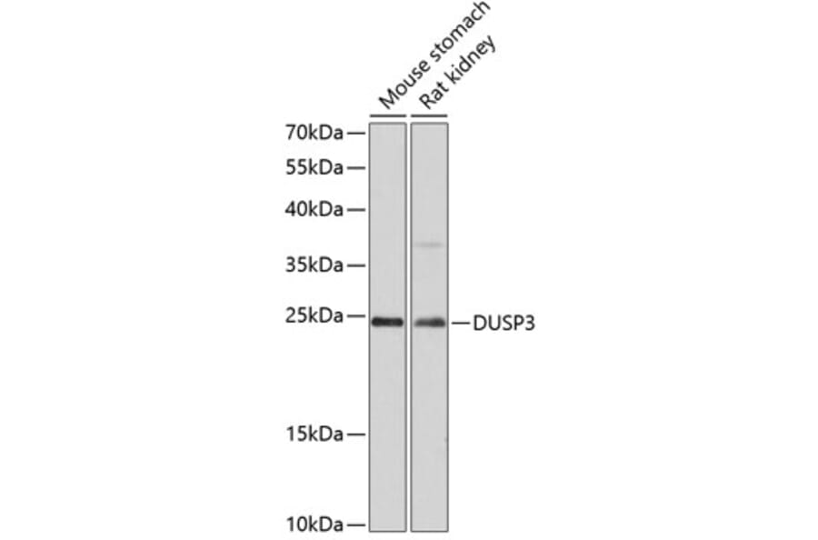 Western Blot - Anti-DUSP3 Antibody (A80926) - Antibodies.com