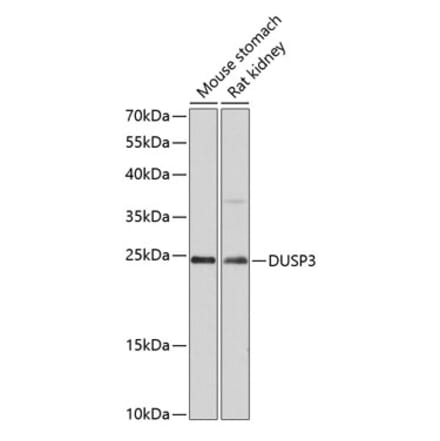 Western Blot - Anti-DUSP3 Antibody (A80926) - Antibodies.com