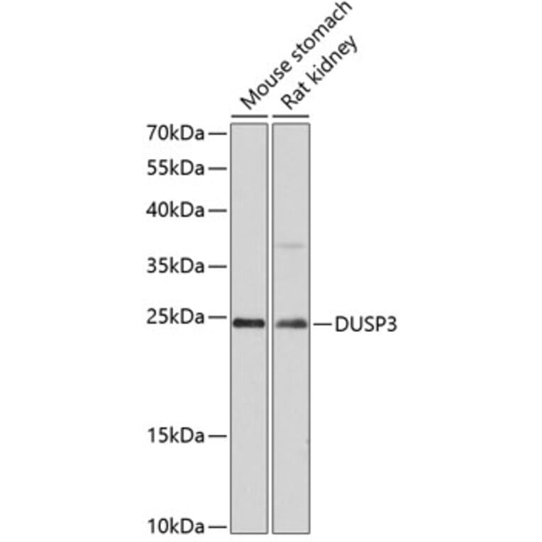 Western Blot - Anti-DUSP3 Antibody (A80926) - Antibodies.com