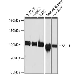 Western Blot - Anti-SEL1L Antibody (A80927) - Antibodies.com