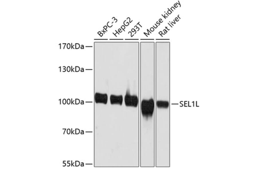 Western Blot - Anti-SEL1L Antibody (A80927) - Antibodies.com