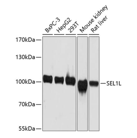 Western Blot - Anti-SEL1L Antibody (A80927) - Antibodies.com