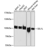 Western Blot - Anti-SEL1L Antibody (A80927) - Antibodies.com