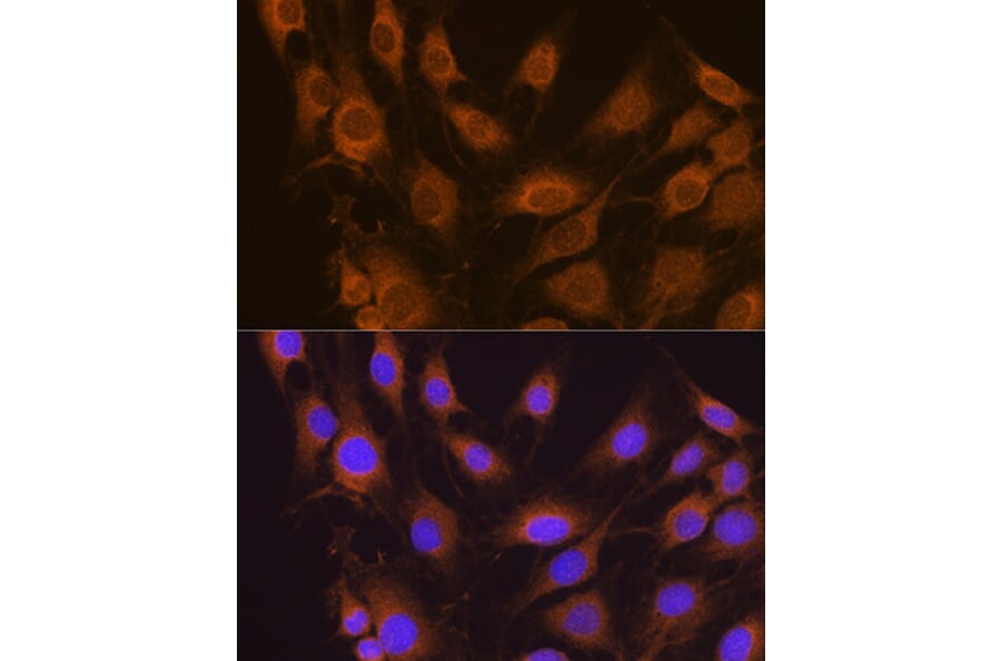 Immunofluorescence - Anti-SEL1L Antibody (A80927) - Antibodies.com