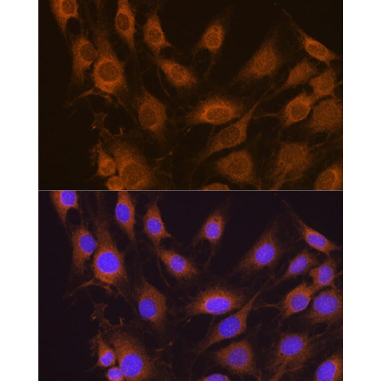 Immunofluorescence - Anti-SEL1L Antibody (A80927) - Antibodies.com