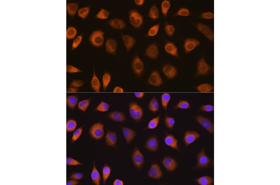 Immunofluorescence - Anti-SEL1L Antibody (A80927) - Antibodies.com