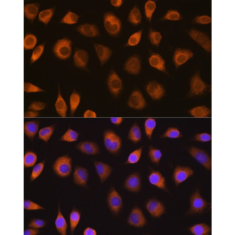 Immunofluorescence - Anti-SEL1L Antibody (A80927) - Antibodies.com