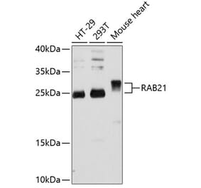 Western Blot - Anti-RAB21 Antibody (A80929) - Antibodies.com