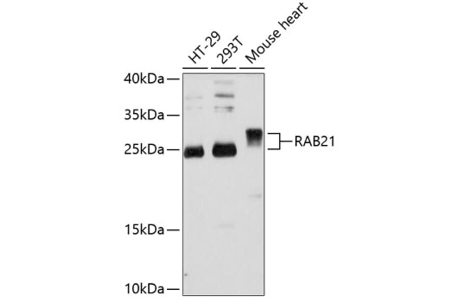 Western Blot - Anti-RAB21 Antibody (A80929) - Antibodies.com