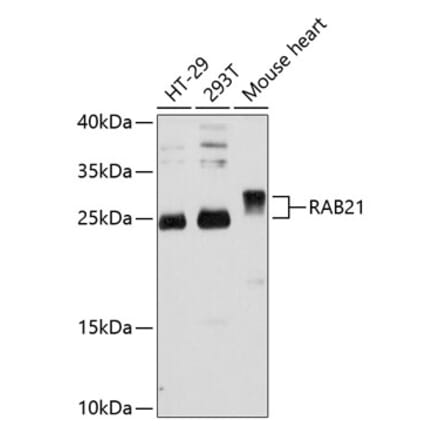 Western Blot - Anti-RAB21 Antibody (A80929) - Antibodies.com