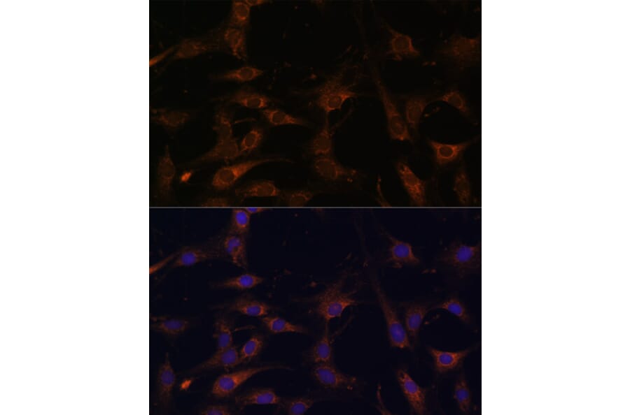 Immunofluorescence - Anti-RAB21 Antibody (A80929) - Antibodies.com