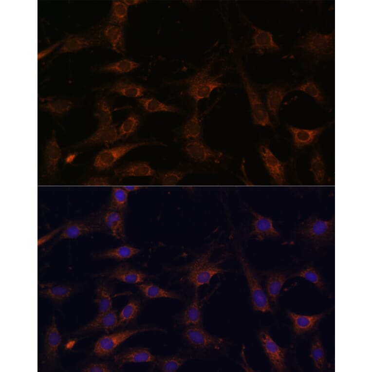 Immunofluorescence - Anti-RAB21 Antibody (A80929) - Antibodies.com