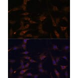 Immunofluorescence - Anti-RAB21 Antibody (A80929) - Antibodies.com