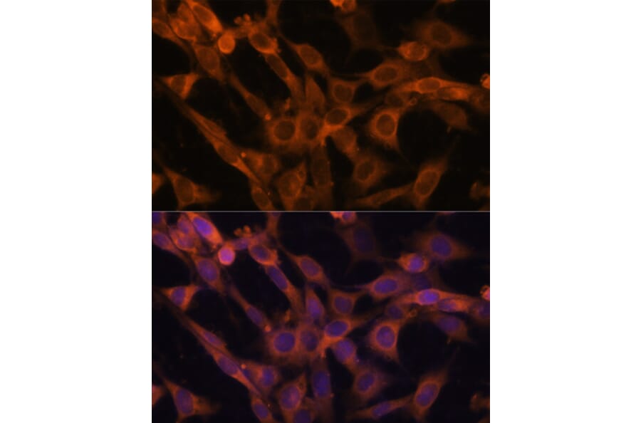 Immunofluorescence - Anti-RAB21 Antibody (A80929) - Antibodies.com