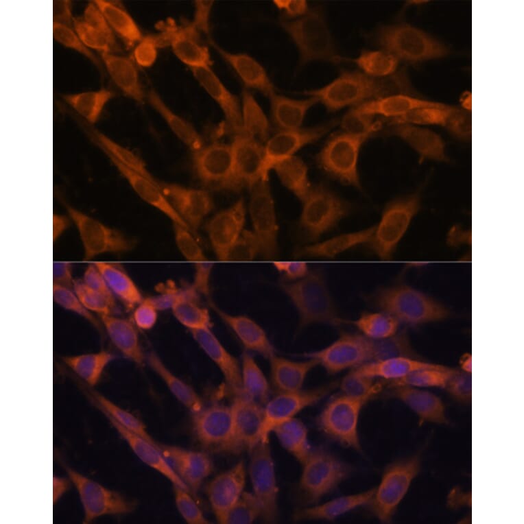 Immunofluorescence - Anti-RAB21 Antibody (A80929) - Antibodies.com