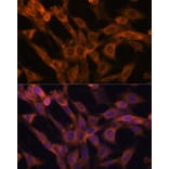 Immunofluorescence - Anti-RAB21 Antibody (A80929) - Antibodies.com