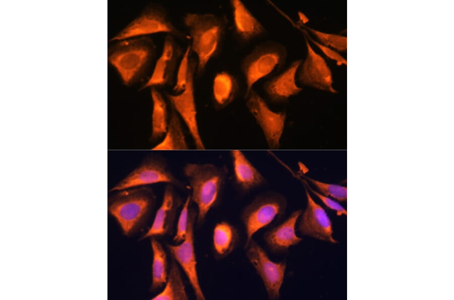 Immunofluorescence - Anti-RAB21 Antibody (A80929) - Antibodies.com