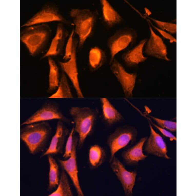 Immunofluorescence - Anti-RAB21 Antibody (A80929) - Antibodies.com
