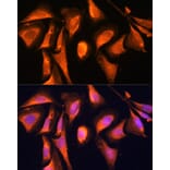 Immunofluorescence - Anti-RAB21 Antibody (A80929) - Antibodies.com