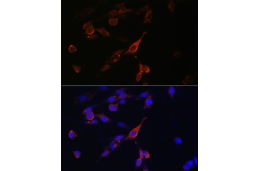 Immunofluorescence - Anti-RAB21 Antibody (A80929) - Antibodies.com