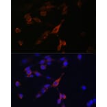 Immunofluorescence - Anti-RAB21 Antibody (A80929) - Antibodies.com