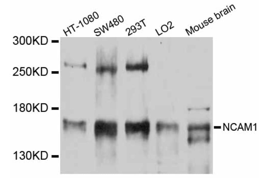 Western Blot - Anti-NCAM1 Antibody (A12112) - Antibodies.com