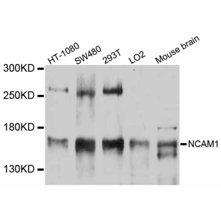 Western Blot - Anti-NCAM1 Antibody (A12112) - Antibodies.com