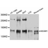 Western Blot - Anti-NCAM1 Antibody (A12112) - Antibodies.com